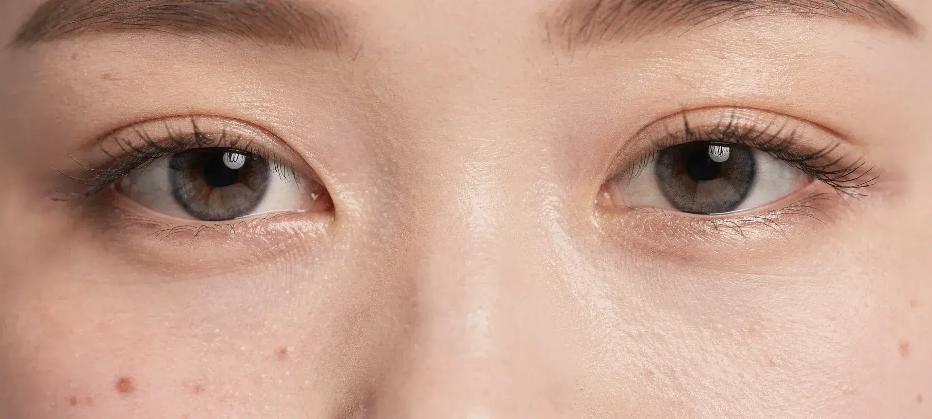 韓國雙眼皮手術