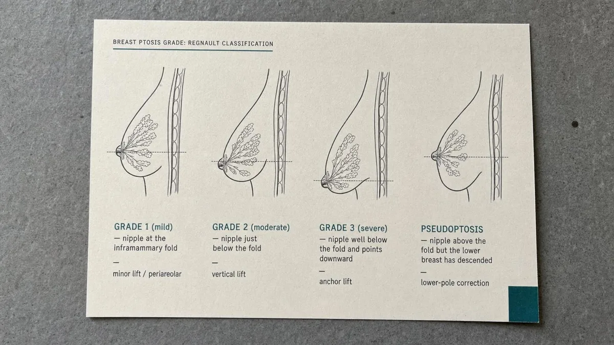 korean-breast-lift-mastopexy-vs-augmentation 相關圖片