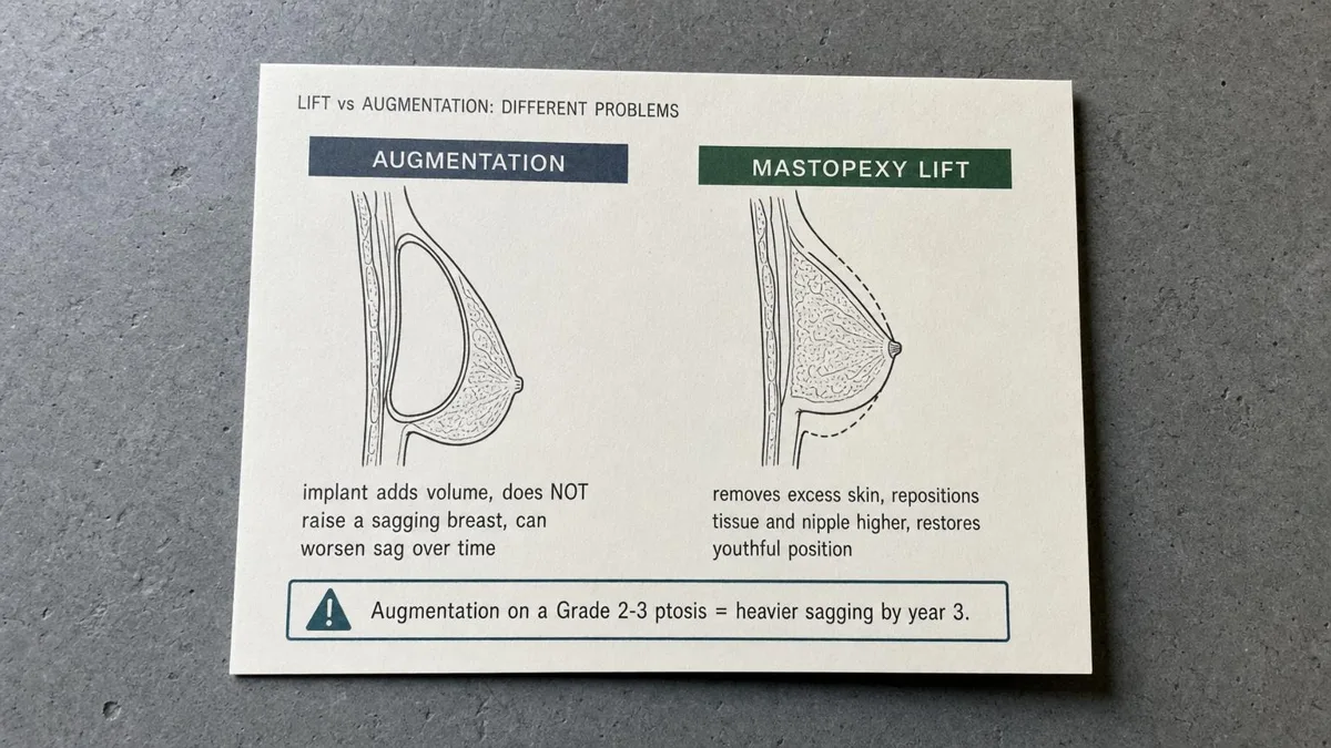 korean-breast-lift-mastopexy-vs-augmentation 相關圖片