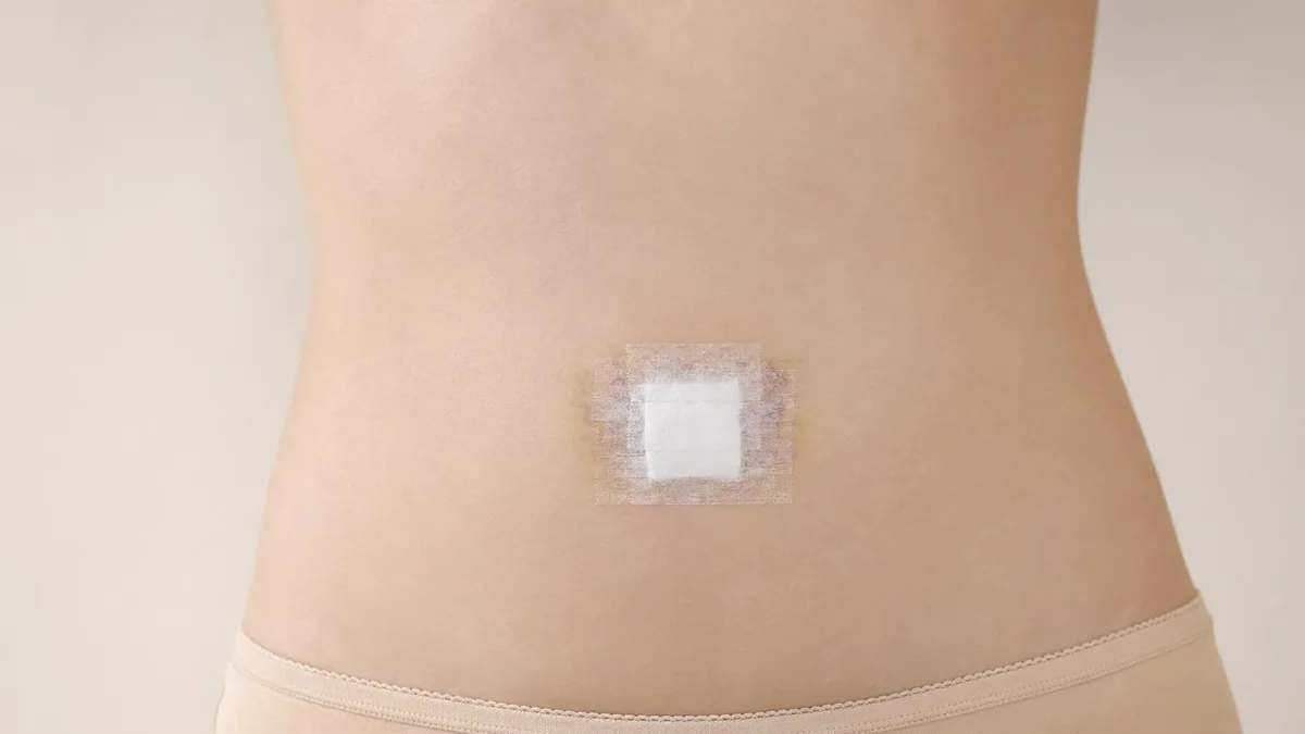 korean-umbilicoplasty-4-belly-button-types 相關圖片